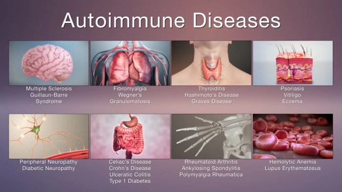 Autoimmune inflammation chronic immune autoimmunity disorders etiology autoinflammatory treatments leads medicine Autoimmune inflammation chronic immune autoimmunity disorders etiology autoinflammatory treatments leads medicine